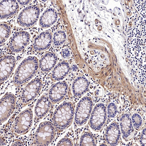 Vinculin Recombinant Mouse mAb (S-916-217)