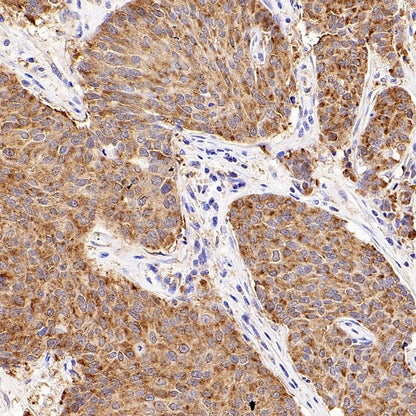 IMPDH2 Rabbit Polyclonal Antibody