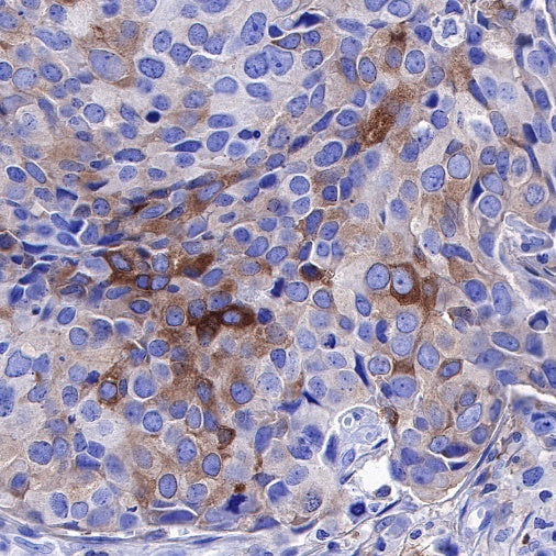 PKC alpha Recombinant Rabbit mAb (S-624-36)