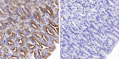 Phospho-PDHA1 (S293) Recombinant Rabbit mAb (S-1729-25)