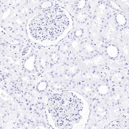 CXCL13 Recombinant Rabbit mAb (SDT-2703-132)