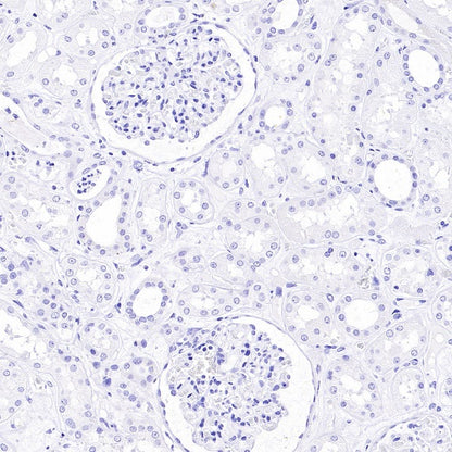 CXCL13 Recombinant Rabbit mAb (SDT-2703-132)