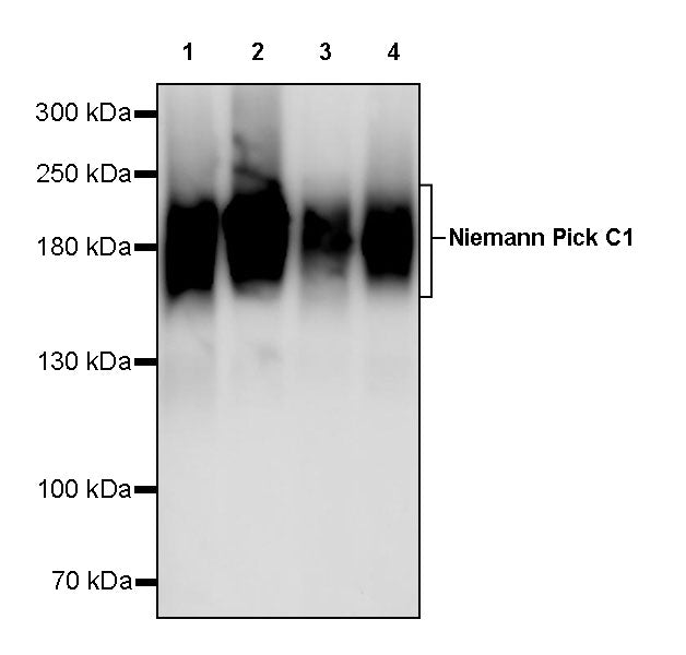 Niemann Pick C1 Recombinant Rabbit mAb (S-5243)