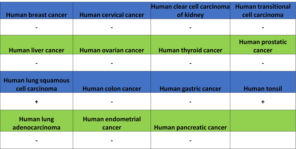 SHIP1 Recombinant Rabbit mAb (S-4235-32)