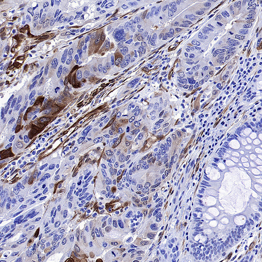 Phospho-HSP27 (Ser82) Recombinant Rabbit mAb (S-4792)