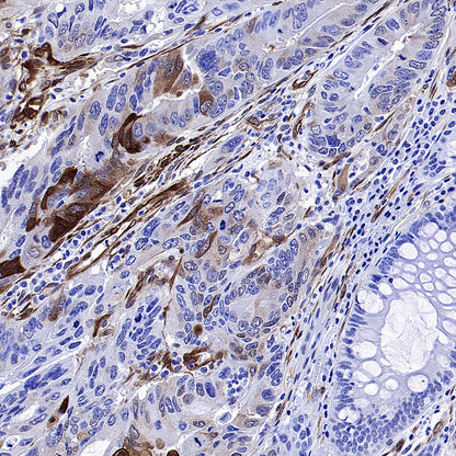 Phospho-HSP27 (Ser82) Recombinant Rabbit mAb (S-4792)