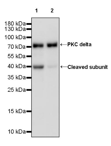 PKC delta Recombinant Rabbit mAb (S-1667-50)