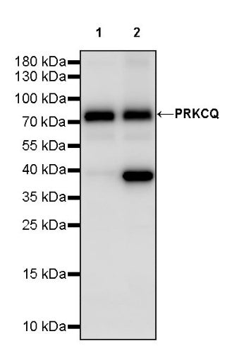 PRKCQ Recombinant Rabbit mAb (S-2511-11)