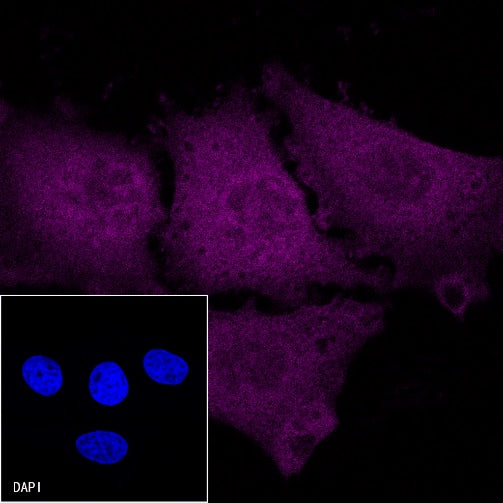 p16 Recombinant Rabbit mAb (Cy5 Conjugate) (S-303-1)