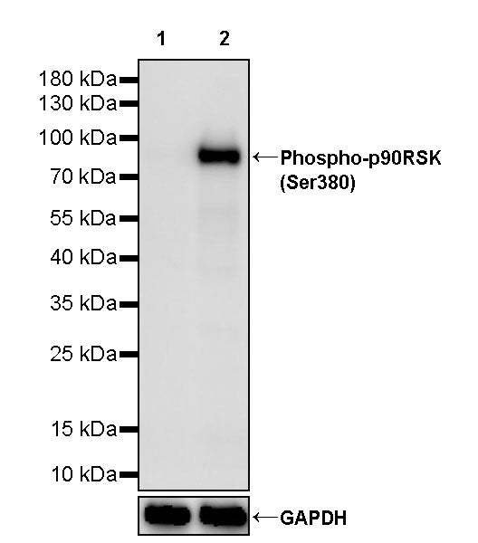 Phospho-p90RSK (Ser380) Recombinant Rabbit mAb (S-4985)