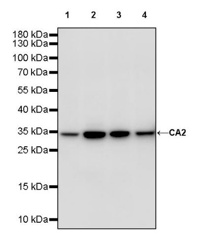 CA2 Rabbit Polyclonal Antibody