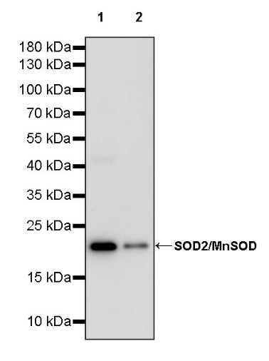 SOD2/MnSOD Rabbit Polyclonal Antibody