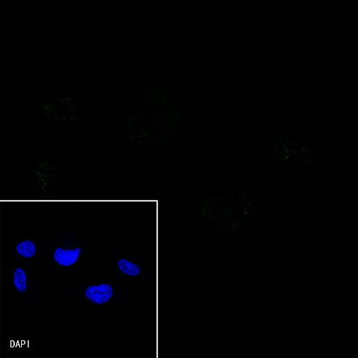 E-Cadherin Recombinant Rabbit mAb (SDT-438-45)