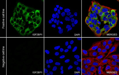 IGF2BP1 Recombinant Rabbit mAb (S-2947-19)