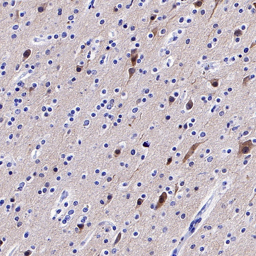 Pan Trk Recombinant Rabbit mAb (SDT-400-39)