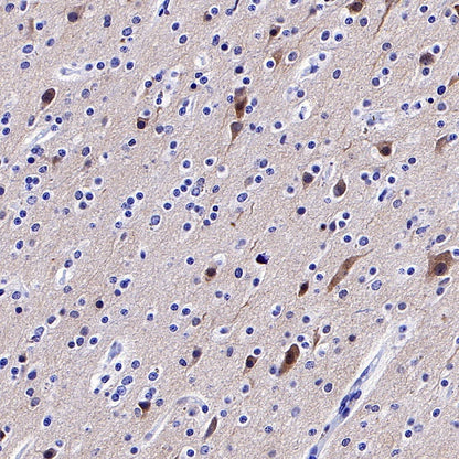 Pan Trk Recombinant Rabbit mAb (SDT-400-39)