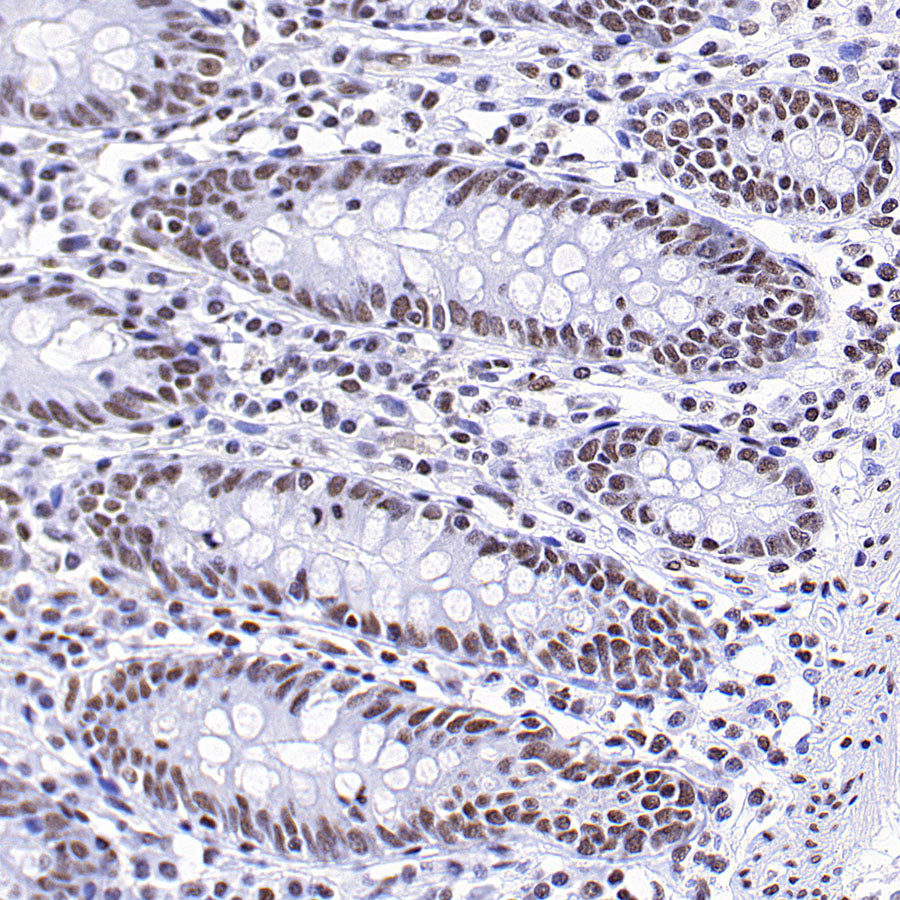 Brd4 Recombinant Rabbit mAb (S-5145)