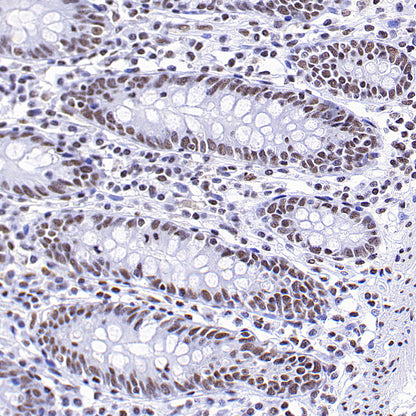 Brd4 Recombinant Rabbit mAb (S-5145)