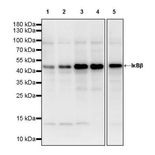 IκBβ Recombinant Rabbit mAb (S-810-203)