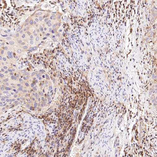 CD100/Semaphorin-4D Recombinant Rabbit mAb (S-3651-16)