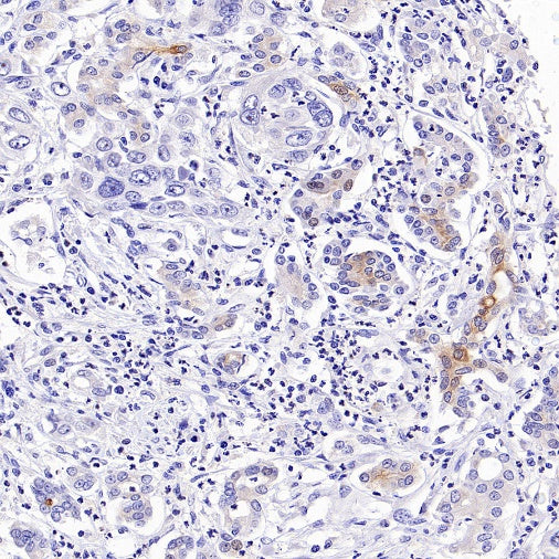 Phospho-IKKα/β (Ser176/180) Recombinant Rabbit mAb (S-4059)
