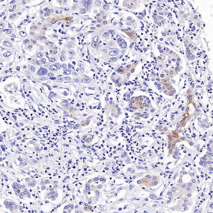 Phospho-IKKα/β (Ser176/180) Recombinant Rabbit mAb (S-4059)