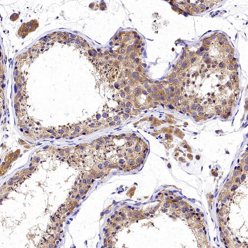 GORASP2 Recombinant Rabbit mAb (S-2526-47)