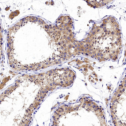 GORASP2 Recombinant Rabbit mAb (S-2526-47)
