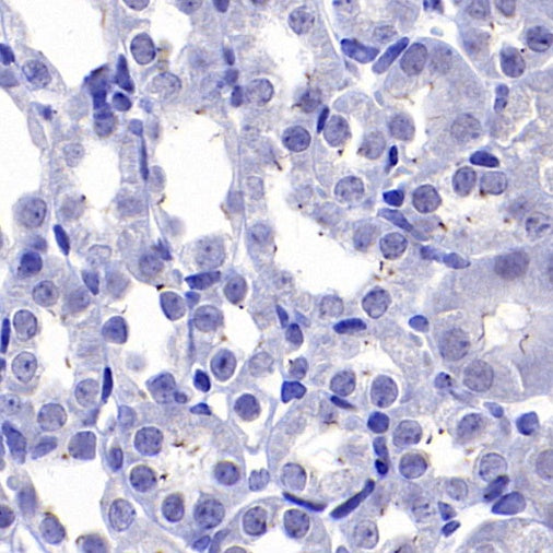 ARL13B Recombinant Rabbit mAb (S-2113-11)