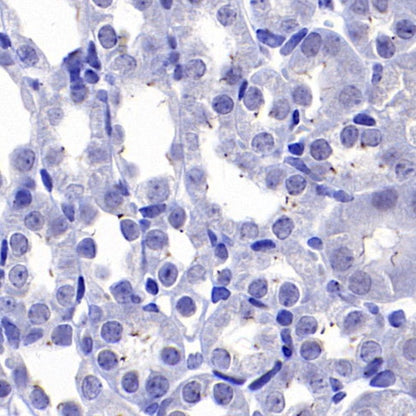 ARL13B Recombinant Rabbit mAb (S-2113-11)
