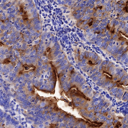 Mesothelin Recombinant Rabbit mAb (SDT-347-15)
