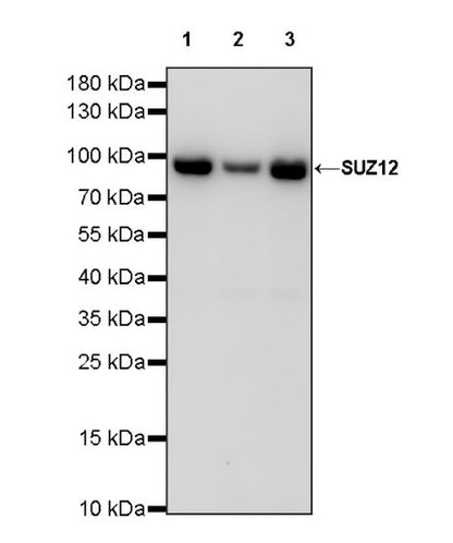 SUZ12 Recombinant Rabbit mAb (S-1689-3)