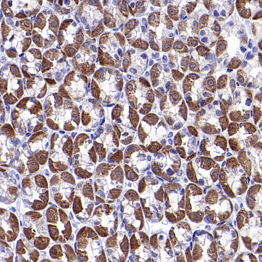 CHCHD10 Recombinant Rabbit mAb (S-4106-13)