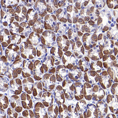 CHCHD10 Recombinant Rabbit mAb (S-4106-13)