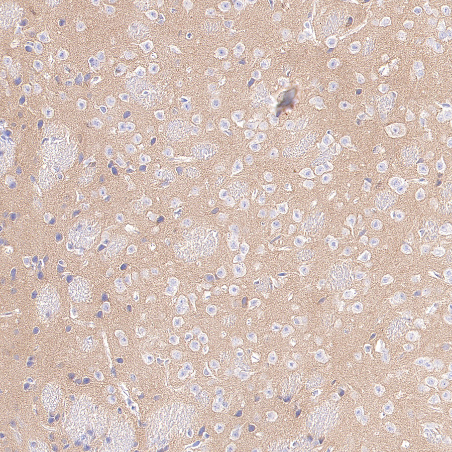 ROBO2 Recombinant Rabbit mAb (S-4563-43)