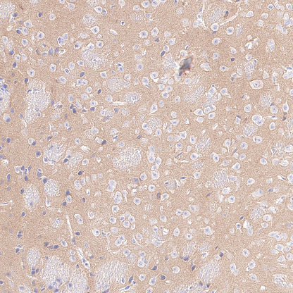 ROBO2 Recombinant Rabbit mAb (S-4563-43)