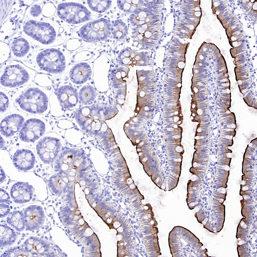 ALPI Recombinant Rabbit mAb (S-3768-104)