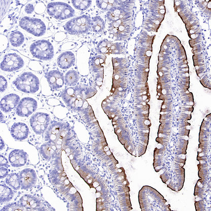 ALPI Recombinant Rabbit mAb (S-3768-104)