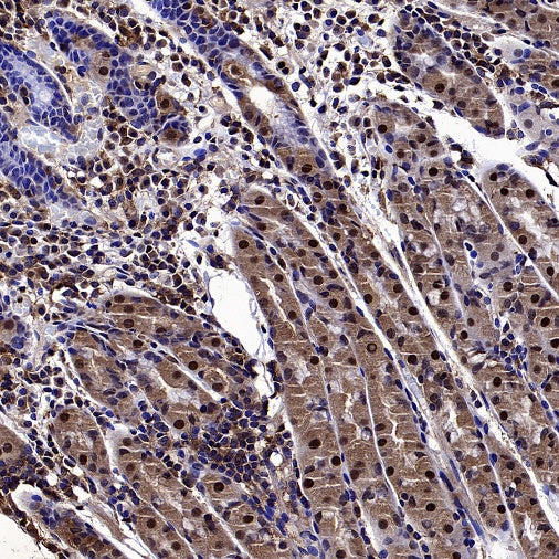 mTOR Recombinant Rabbit mAb (S-698-228)