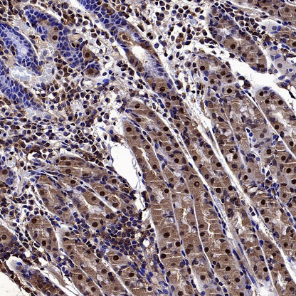 mTOR Recombinant Rabbit mAb (S-698-228)