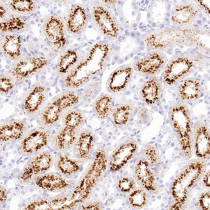 Napsin A Recombinant Mouse mAb (SDT-4204)