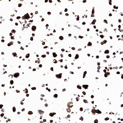 SEZ6 Recombinant Rabbit mAb (SDT-2097-7)
