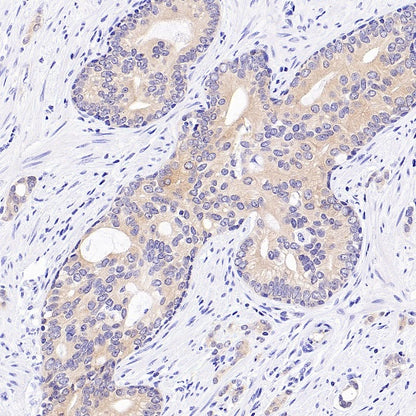 p90RSK Recombinant Rabbit mAb (S-1024-26)