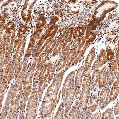 S-RMab® Stat6 Recombinant Rabbit mAb (SDT-337-32)