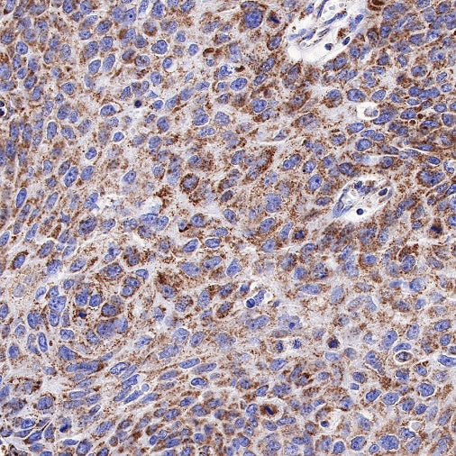 PTP1B Recombinant Rabbit mAb (S-R336)