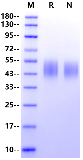 SLAMF1/SLAM/CD150 His Tag Protein, Human