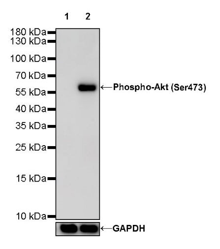Phospho-Akt (Ser473) Recombinant Rabbit mAb (S-510-64)