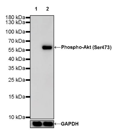 Phospho-Akt (Ser473) Recombinant Rabbit mAb (S-510-64)