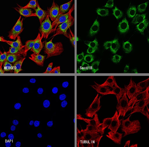 Sec61B Recombinant Rabbit mAb (S-4499-3)