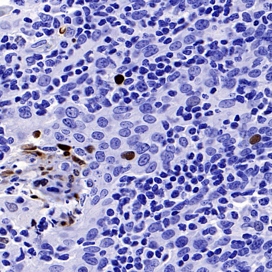 Phospho-DNA-PKcs (Ser2056) Recombinant Rabbit mAb (S-3813)